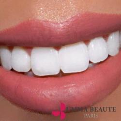 Blanchiment Dentaire - Umma Beauté  Montreuil