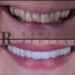 Médecin généraliste Dr Ramzi Redissi - Chirurgien dentiste - Paris 8 - 1 - 