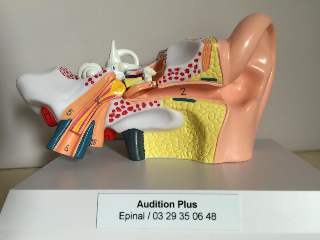 Audition +  Epinal